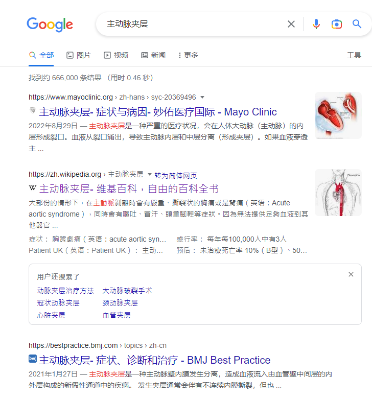 高血压群体应注意主动脉夹层,以及医学方面网络上信源质量的比较