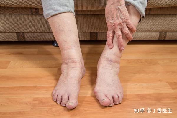 老年鞋是骗人产品吗?老人如何选择鞋子?