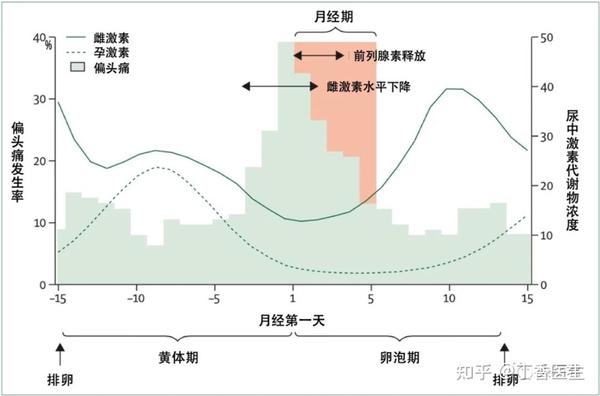 导致女性偏头痛的重要原因，终于找到了（不是压力和熬夜）