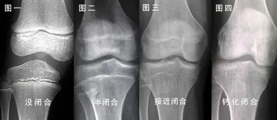 成年后怎么样才能再次长高?