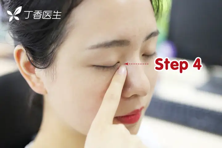 最正确的滴眼药水操作步骤是怎样的?