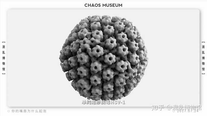 嘴唇上火?单纯疱疹病毒HSV-1