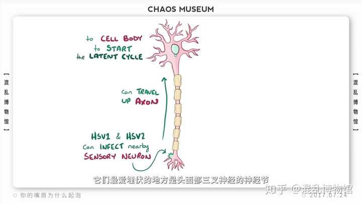 嘴唇上火?单纯疱疹病毒HSV-1